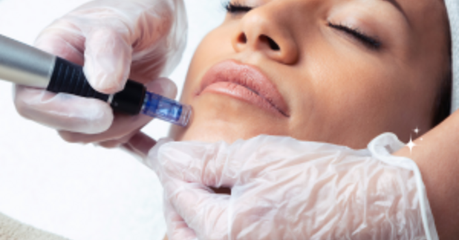 Microneedeling
